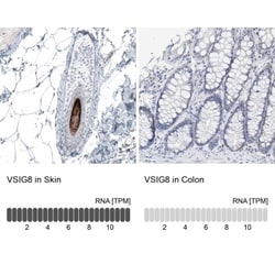 CTR2 Antibody, Novus Biologicals:Antibodies:Primary Antibodies